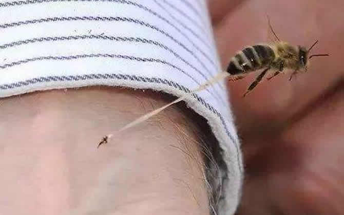 被蜜蜂蟄了怎么處理才好? 被蜜蜂蟄了